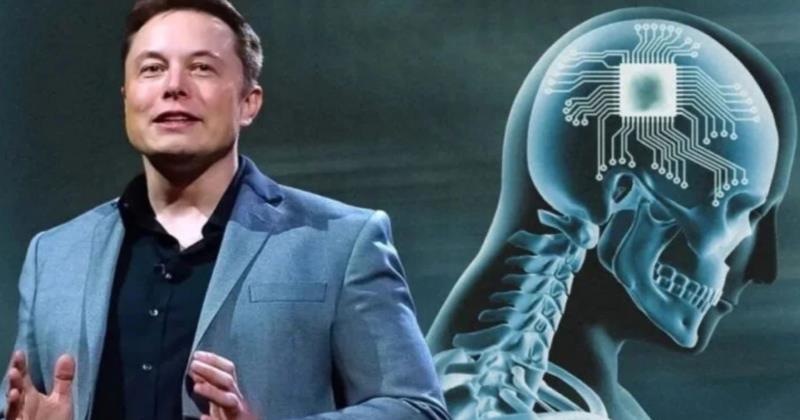 Elon Musk Announces Successful Brain Chip Implantation in Humans